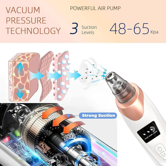 Blackhead Remover Vacuum, Electric BlackHead Vacuum Remover for Face, Wireless Portable All Skin Types for Nose, Face Pore Vacuum with 5 Interchangeable Tips Rechargeable,Suitable for Women/Men