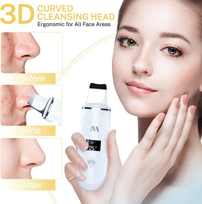 Misiki Facial Scrubber Spatula 4 Functional Modes Blackhead Remover for Facial Skin Cleaning USB Rechargeable